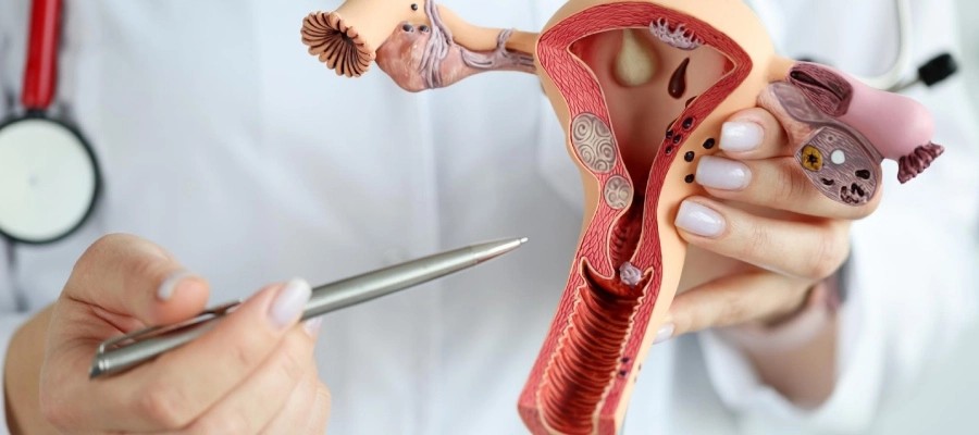 Imagem do post Quem tem endometriose pode engravidar? Obstáculos e opções de tratamento